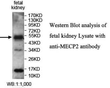 Anti-MECP2