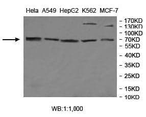 Anti-MGAT4A