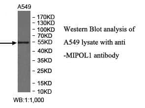 Anti-MIPOL1