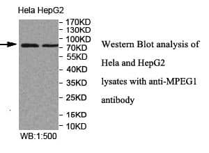 Anti-MPEG1