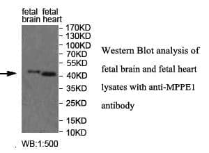 Anti-MPPE1