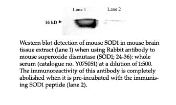 Anti-Mouse superoxide dismutase (SOD1, 24-36)
