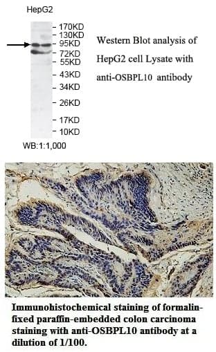 Anti-OSBPL10