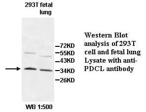 Anti-PDCL