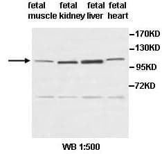 Anti-PDE3A
