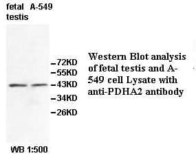 Anti-PDHA2