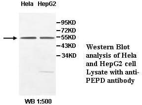 Anti-PEPD