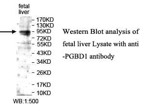 Anti-PGBD1