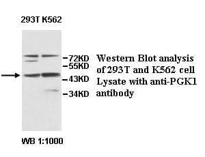 Anti-PGK1