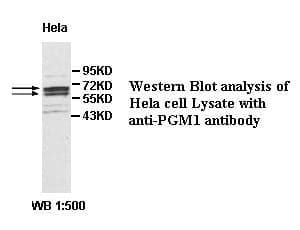 Anti-PGM1