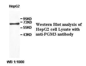 Anti-PGM3