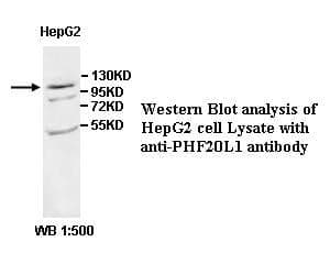 Anti-PHF20L1