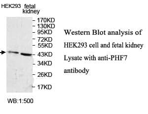 Anti-PHF7