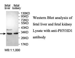 Anti-PHYHD1