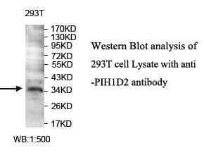 Anti-PIH1D2