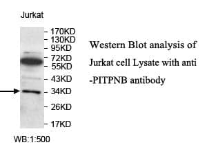 Anti-PITPNB