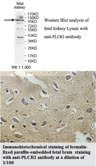 Anti-PLCB2