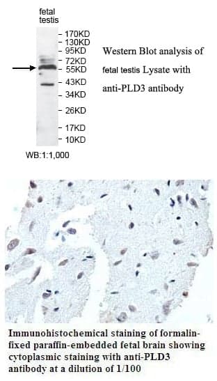 Anti-PLD3