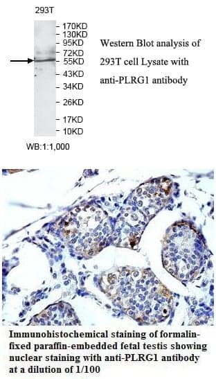 Anti-PLRG1