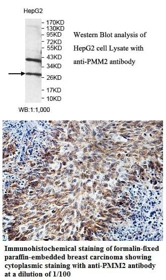 Anti-PMM2