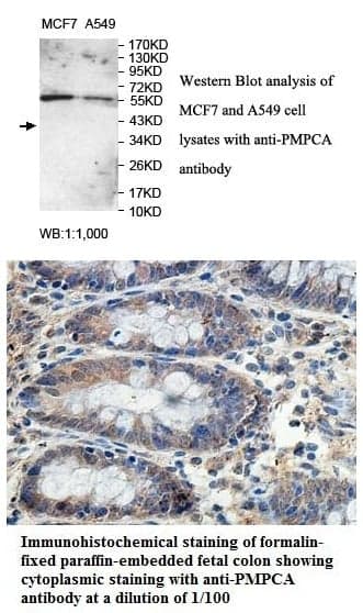 Anti-PMPCA