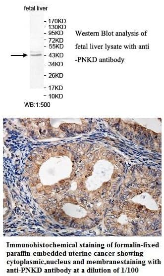 Anti-PNKD