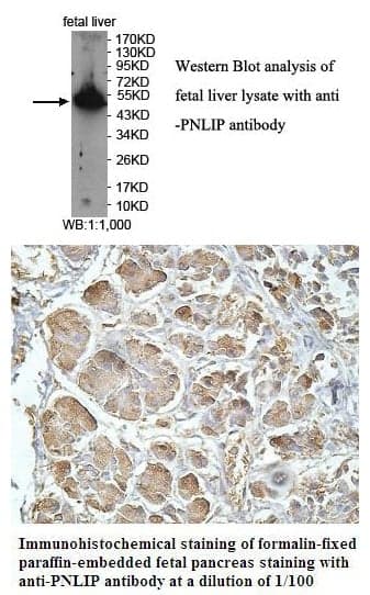 Anti-PNLIP