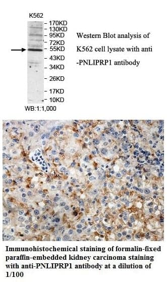 Anti-PNLIPRP1