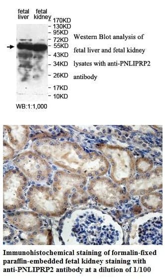 Anti-PNLIPRP2