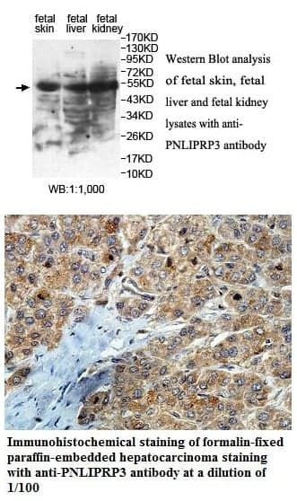 Anti-PNLIPRP3