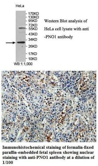 Anti-PNO1