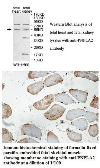 Anti-PNPLA2