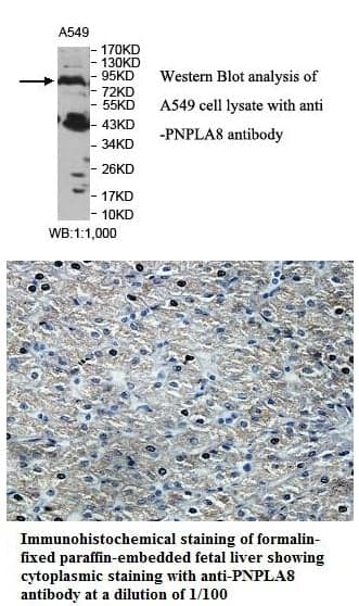Anti-PNPLA8
