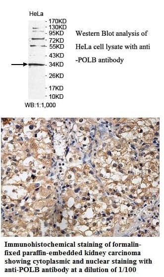Anti-POLB