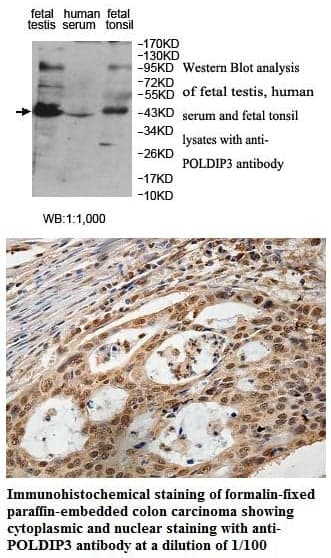 Anti-POLDIP3