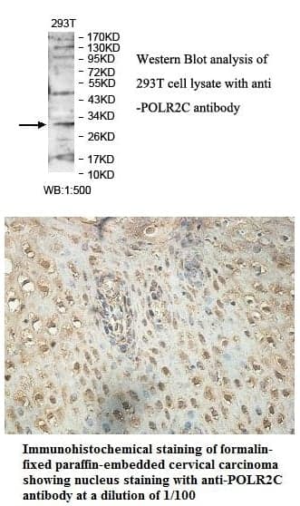 Anti-POLR2C