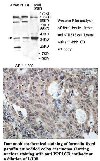 Anti-PPP1CB