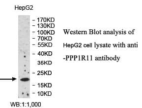 Anti-PPP1R11