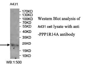 Anti-PPP1R14A