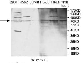 Anti-PPP1R16B