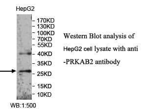 Anti-PRKAB2