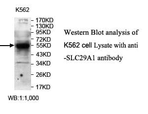 Anti-SLC29A1