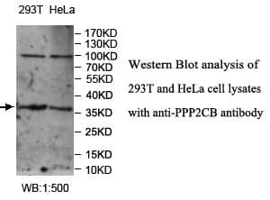 Anti-PPP2CB