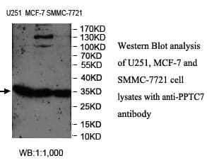 Anti-PPTC7