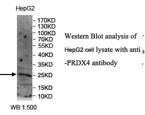 Anti-PRDX4