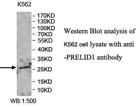 Anti-PRELID1