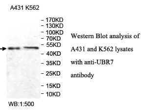 Anti-UBR7