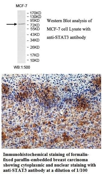 Anti-STAT3