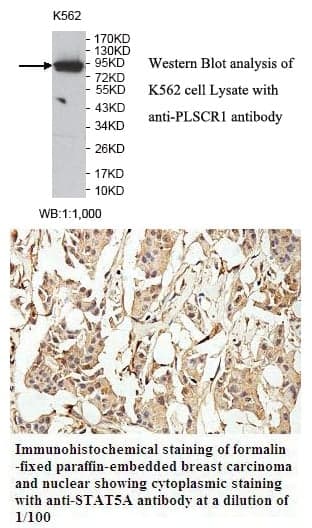 Anti-STAT5A
