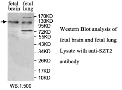Anti-SZT2